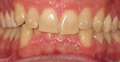 Before & Afters Before & Afters