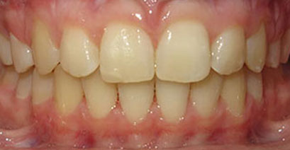 Before & Afters Before & Afters