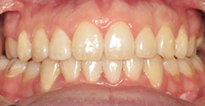 Before & Afters Before & Afters