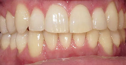 Before & Afters Before & Afters