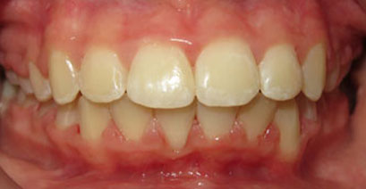 Before & Afters Before & Afters