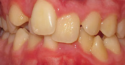 Before & Afters Before & Afters