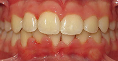 Before & Afters Before & Afters