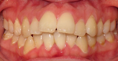 Before & Afters Before & Afters