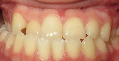 Before & Afters Before & Afters