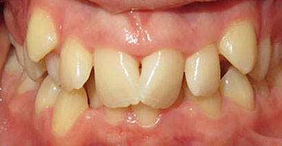 Before & Afters Before & Afters