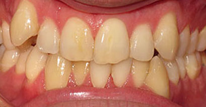 Before & Afters Before & Afters