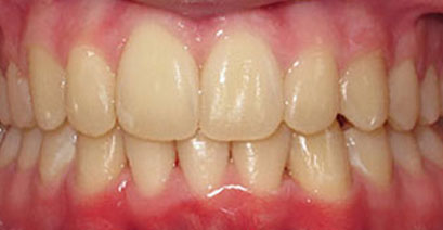 Before & Afters Before & Afters
