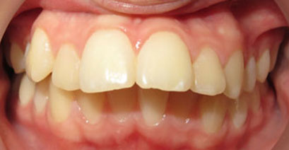 Before & Afters Before & Afters