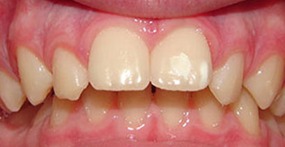 Before & Afters Before & Afters