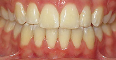 Before & Afters Before & Afters