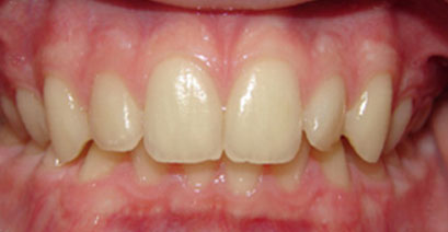 Before & Afters Before & Afters