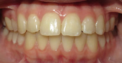 Before & Afters Before & Afters