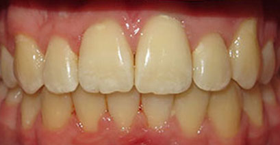 Before & Afters Before & Afters