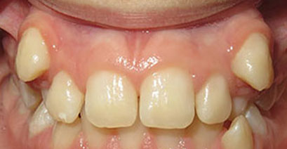 Before & Afters Before & Afters