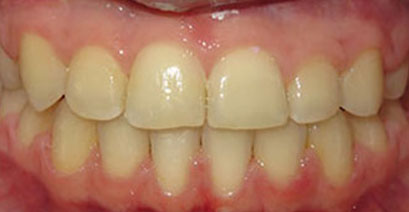 Before & Afters Before & Afters