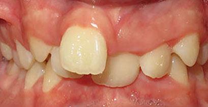 Before & Afters Before & Afters