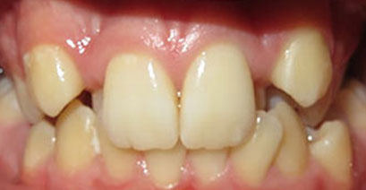 Before & Afters Before & Afters