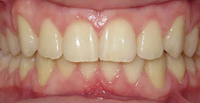 Before & Afters Before & Afters