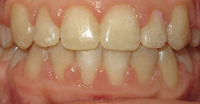 Before & Afters Before & Afters