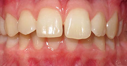 Before & Afters Before & Afters