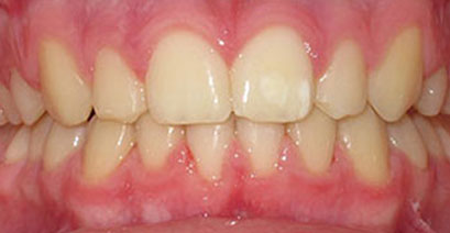 Before & Afters Before & Afters