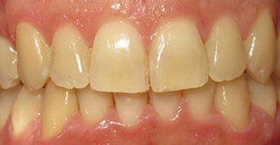 Before & Afters Before & Afters