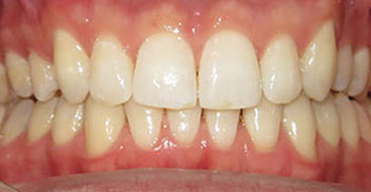 Before & Afters Before & Afters
