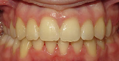 Before & Afters Before & Afters